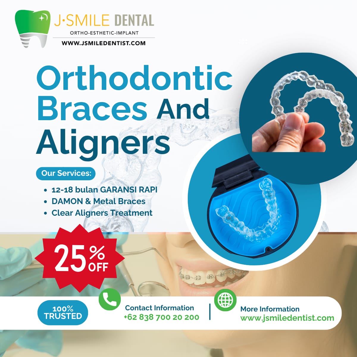 Orthodontic Braces and Aligners, 25% Off