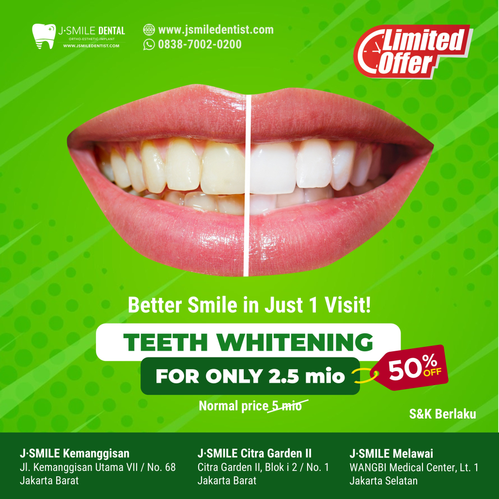 X-2025-09-Ads-whitening